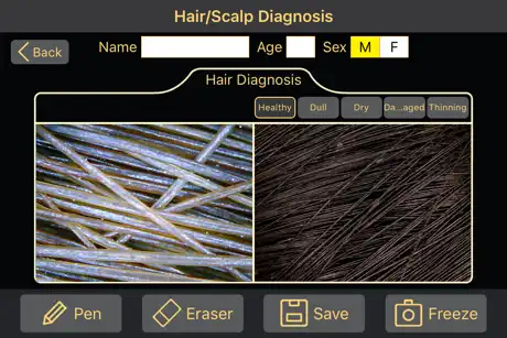 Diagnosis