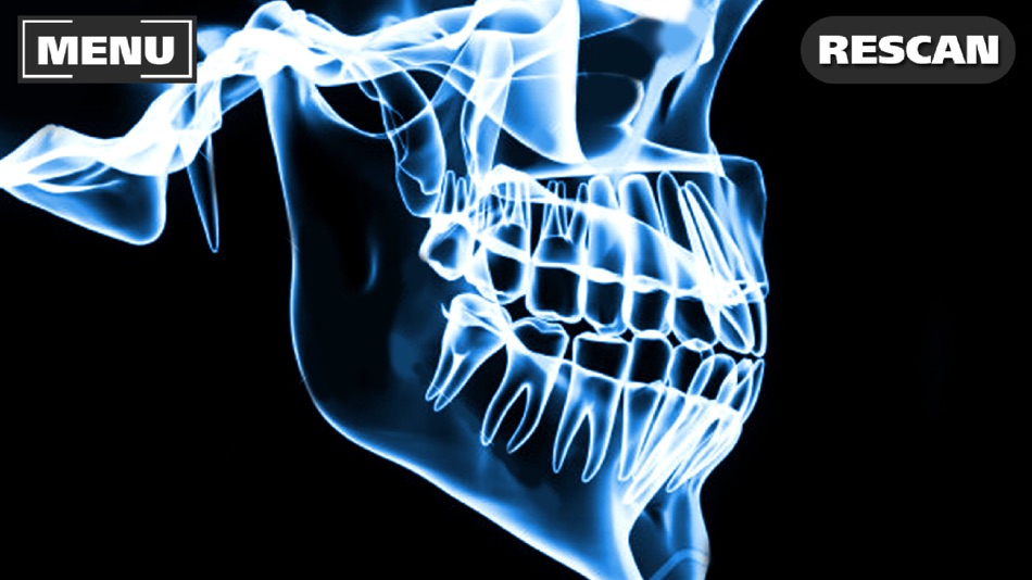 #2. Xray Scanner Teeth Prank (iOS) 由: Stepan Ivanov