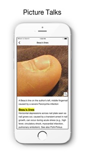 Eponyms - Disease Picture and Medical Tutor screenshot #3 for iPhone