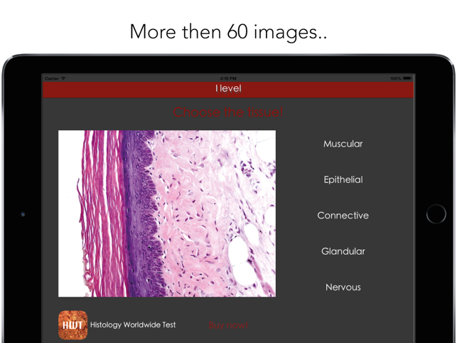 Histology Worldwide Test Lite for iPad(圖2)-速報App