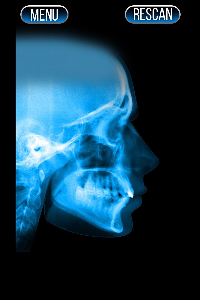 Xray Scanner Nose Prank screenshot 2