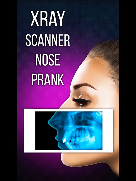 Screenshot #5 pour Xray Scanner Nose Prank