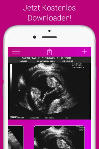 Ultrasound Prank Free - Pregnant Spoof And Fake Pregnancy Trick screenshot 4