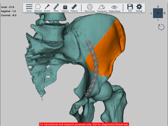Screenshot #4 pour Ossa 3D