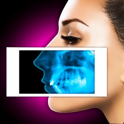 Xray Scanner Nose Prank