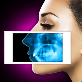 Snímky obrazovky (3) Xray Scanner Nose Prank
