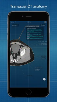 X-Anatomy Basic iPhone image 1