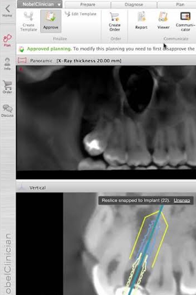 NobelClinician® Tutorial screenshot 3