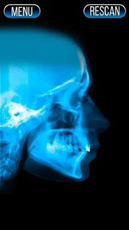 Game screenshot Xray Scanner Nose Prank apk