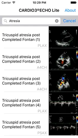 Game screenshot CARDIO3® Comprehensive Atlas of Echocardiography - Lite hack