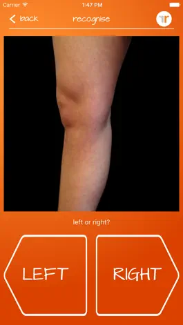 Game screenshot Recognise Knee apk