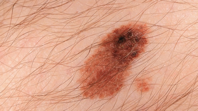 Q-focus Wi-Fi screenshot-4