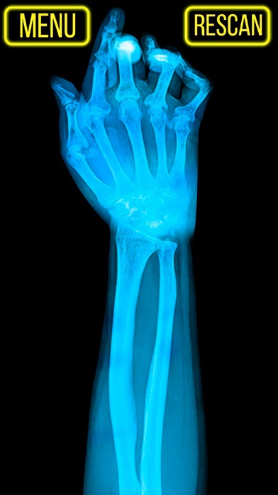 Screenshot #2 pour Xray Fracture Hand Prank
