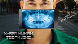 Game screenshot X-Ray Human Teeth Joke hack