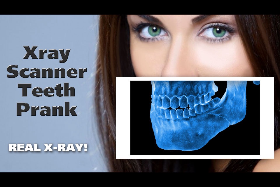 Xray Scanner Teeth Prank screenshot 3