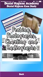 dental hygiene academy - case studies for board review free iphone images 3