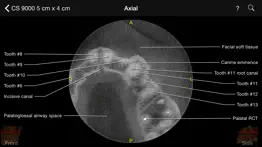 How to cancel & delete cbct 3