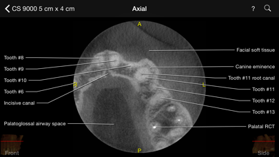 CBCT Screenshot