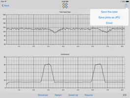 Game screenshot Simulated Electronic Fetal Monitor hack