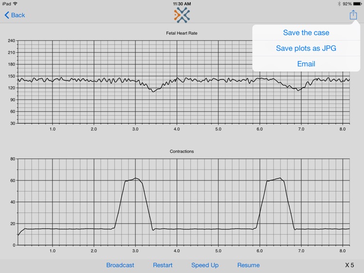 Simulated Electronic Fetal Monitor