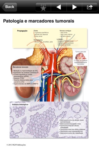 Atlas Câncer Renal screenshot 2