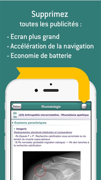 SMARTfiches Rhumatologie screenshot-4