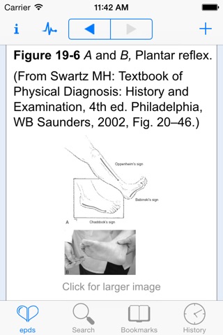 Physical Diagnosis Secrets, 2nd Edition screenshot 3