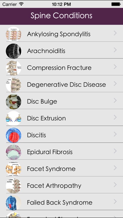 Spine Conditions & Treatment