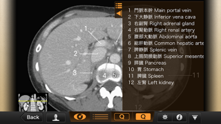 CT・MRI解体新書 screenshot1