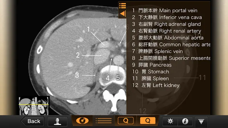 CT・MRI解体新書 screenshot 3 of 5