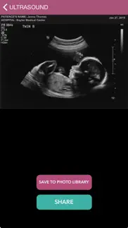 baby ultrasound 2015 iphone screenshot 1