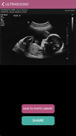 Baby Ultrasound 2015