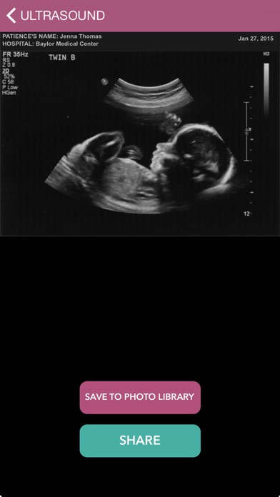 Baby Ultrasound 2015 screenshot 1