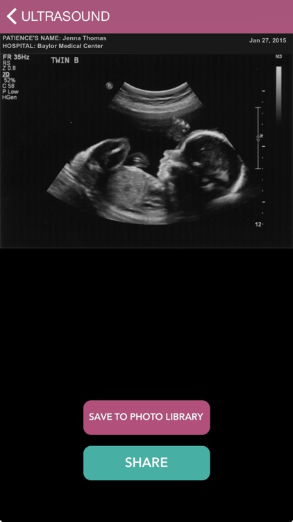 Baby Ultrasound 2015