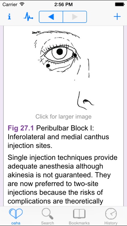 Oxford American Handbook of Anesthesiology