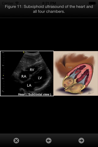 SonoSupport: a clinical emergency medicine and critical care ultrasound reference toolのおすすめ画像5