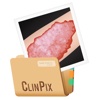 ClinPix