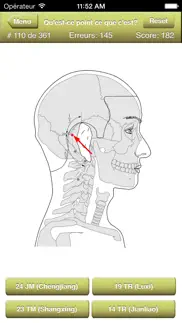 acupuncture points quiz iPhone Captures Décran 2