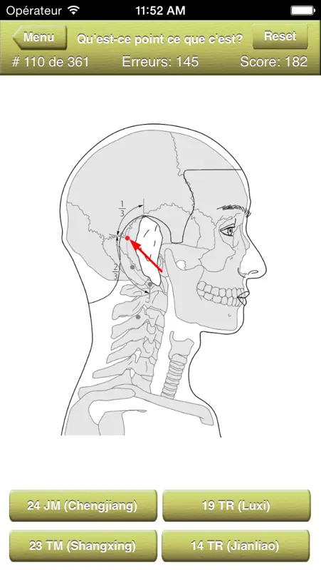 Acupuncture Points Quiz screenshot 2 of 5