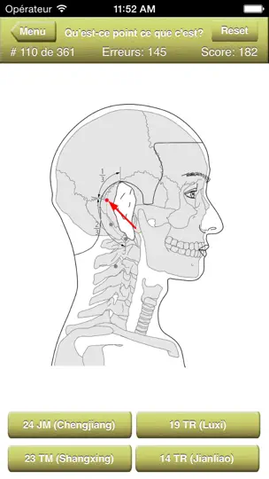 Capture d'écran de Acupuncture Points Quiz sur iPhone 2
