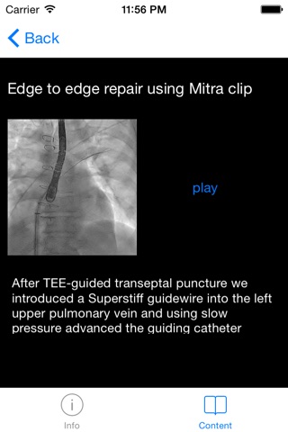 CARDIO3® Interventional Atlas screenshot 4