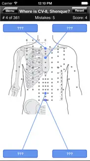 acupuncture points body quiz problems & solutions and troubleshooting guide - 2