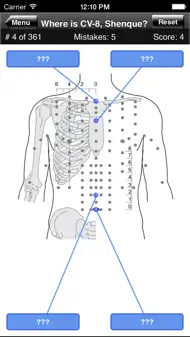 Acupuncture Points Body Quiz iphone bilder 1