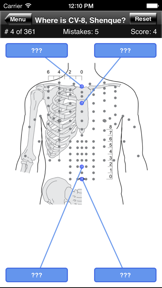 Acupuncture Points Body Quiz screenshot