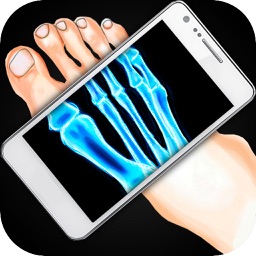 Simulator X-Ray Feet