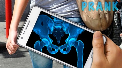 Screenshot #2 pour Simulator X-Ray Hip Bone