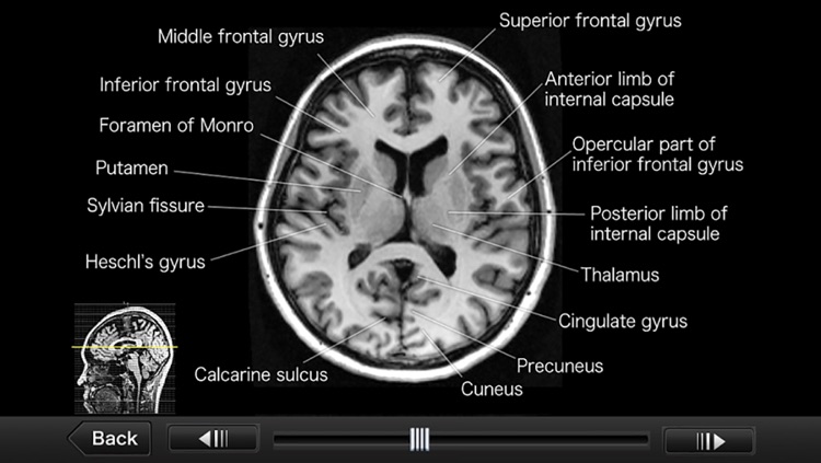 Interactive CT and MRI Anatomy screenshot-4