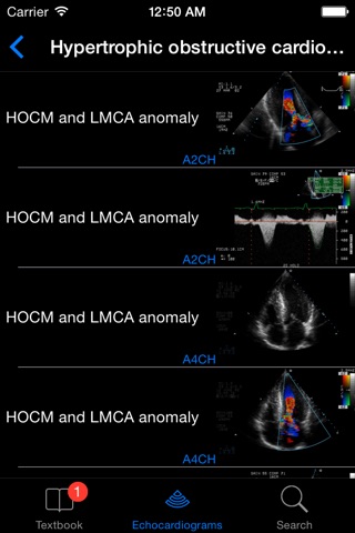 CARDIO3®Echocardiography screenshot 2