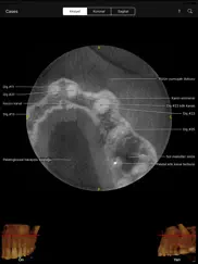 cbct ipad resimleri 2