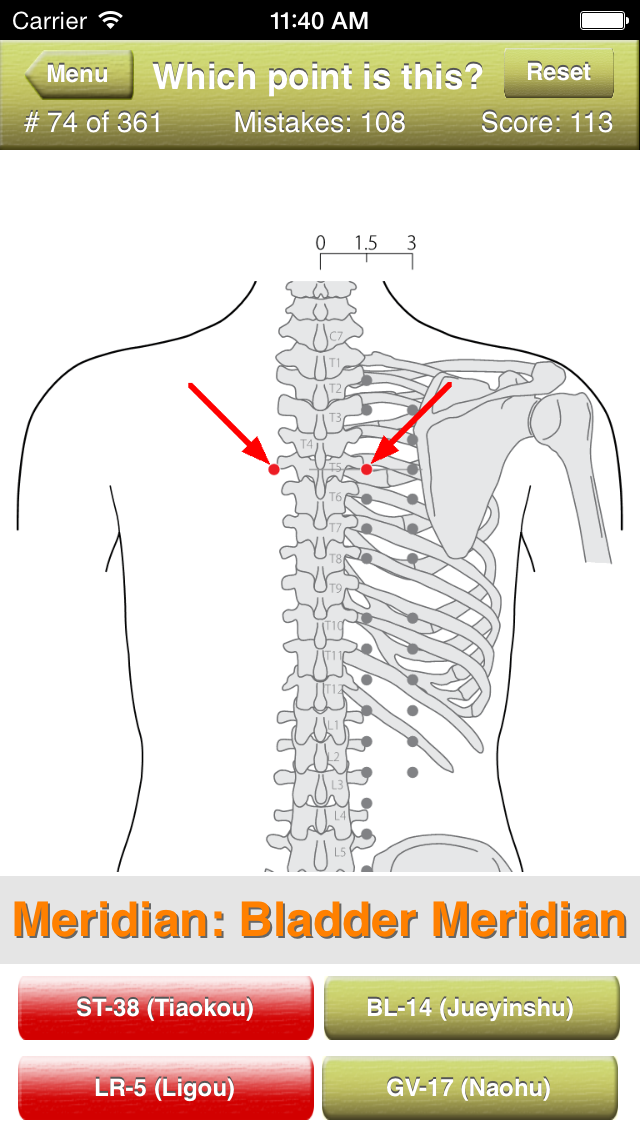 Acupuncture Points Quiz Screenshot 3